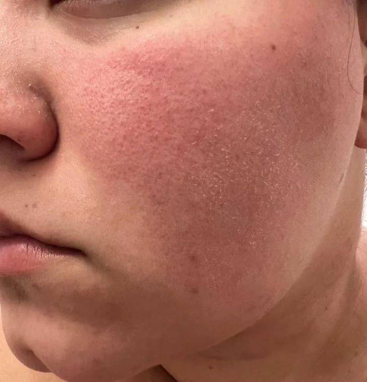 Skin solutions treatment